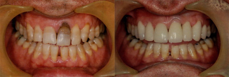 improve smile appointment before